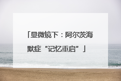 显微镜下：阿尔茨海默症“记忆重启”